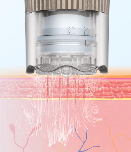MESOPEN - microneedling device - Imagen 3